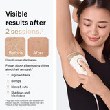 Braun Silk·expert Pro 5 IPL: Alternative to Laser Hair Removal with 2 Caps and Leather Pouch, PL5157